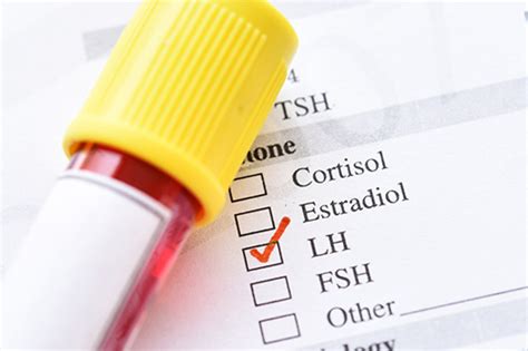 kissasian.lh|lh blood test meaning.